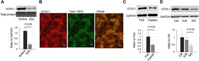 UCHL1 Regulates Lipid and Perilipin 2 Level in Skeletal Muscle